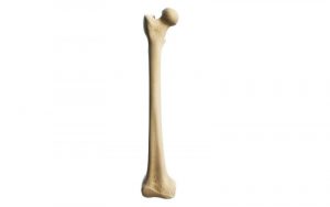 Home 208 femur
